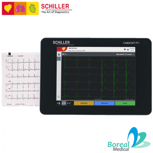 Cardiovit-FT-1 Schiller Impresión Diagnóstico